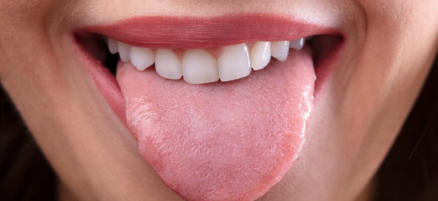 Лейкоплакія: Ознаки, Причини та Ефективні Методи Лікування