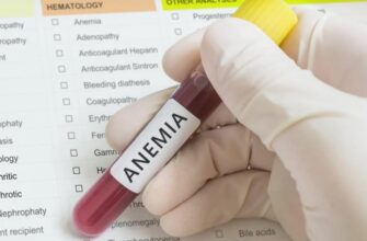 Що таке анемія у дітей: симптоми, причини і методи лікування