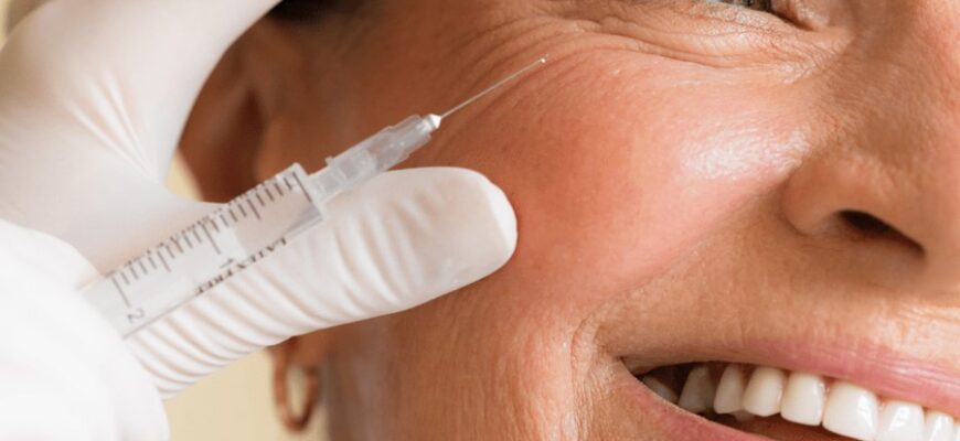 Ботокс: Відкрийте секрети процедури омолодження та її впливу Ботокс: Відкрийте секрети процедури омолодження та її впливу