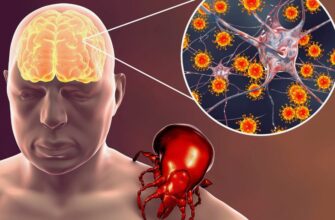 Таємниці енцефаліту: Визначення, симптоми та методи лікування