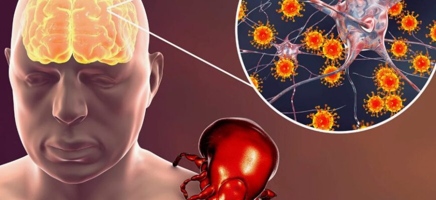Таємниці енцефаліту: Визначення, симптоми та методи лікування