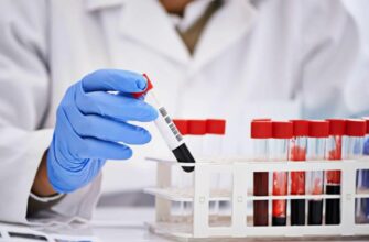 Індекс HOMA: Що це таке і як він впливає на стан здоров’я