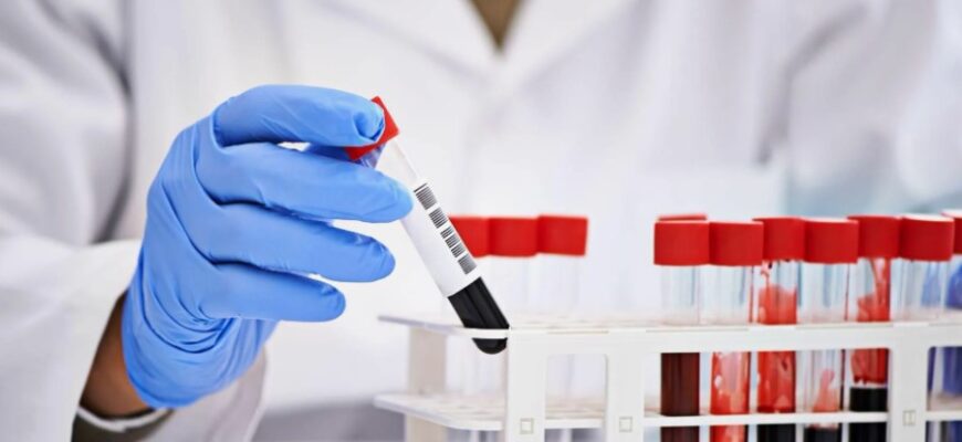 Індекс HOMA: Що це таке і як він впливає на стан здоров’я