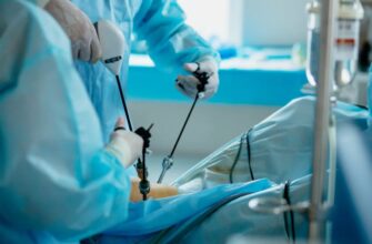 Лапароскопія: Що Це Таке, Переваги та Процес Оперативного Втручання