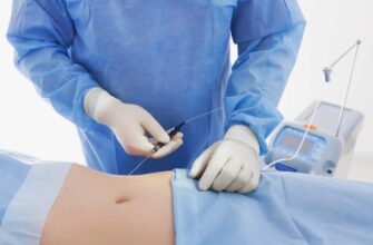 Що таке ліпосакція: докладний гід з методами та ризиками процедури