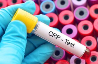 Головний сігнал тривоги: розуміння ролі реактивного білка в організмі