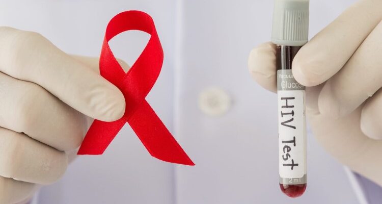 Ефективні стратегії життя з ВІЛ: розуміння інфекції та догляд Ефективні стратегії життя з ВІЛ: розуміння інфекції та догляд