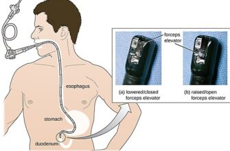 Все про Фіброгастродуоденоскопію: Процедура, Показання та Переваги