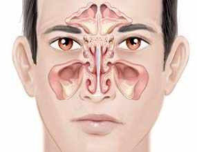 Фронтит: Симптоми, діагностика та ефективні методи лікування хвороби