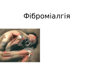 Фіброміалгія: симптоми, діагностика та ефективні методи лікування