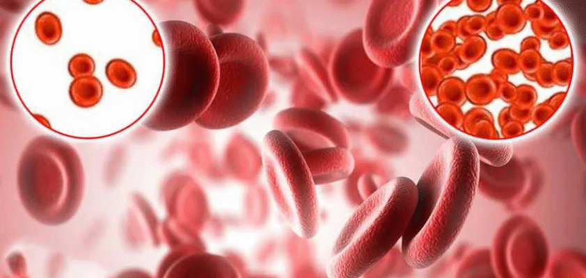 Апластична анемія: Чи може вона бути пов’язана з розвитком раку?