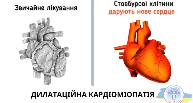 Що таке кардіопатія: важливі аспекти діагностики та лікування