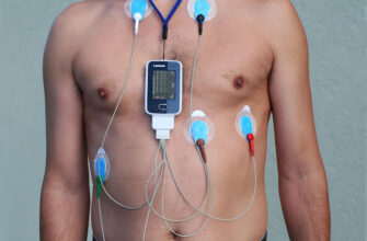Що таке холтер-моніторинг: повний огляд методики та переваг