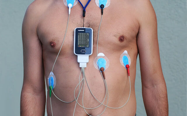 Що таке холтер-моніторинг: повний огляд методики та переваг Що таке холтер-моніторинг: повний огляд методики та переваг