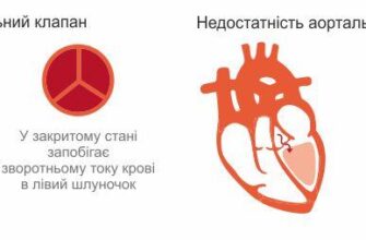 Регургітація: що це таке, причини та способи вирішення проблеми