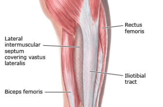 Трохантерит: Причини, симптоми та ефективні методи лікування