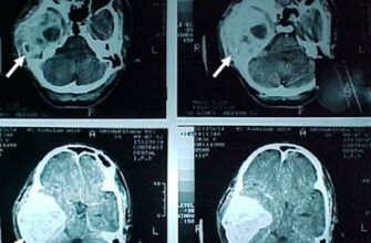 Що таке СКТ: основи, переваги та застосування комп’ютерної томографії