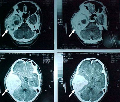 Що таке СКТ: основи, переваги та застосування комп’ютерної томографії