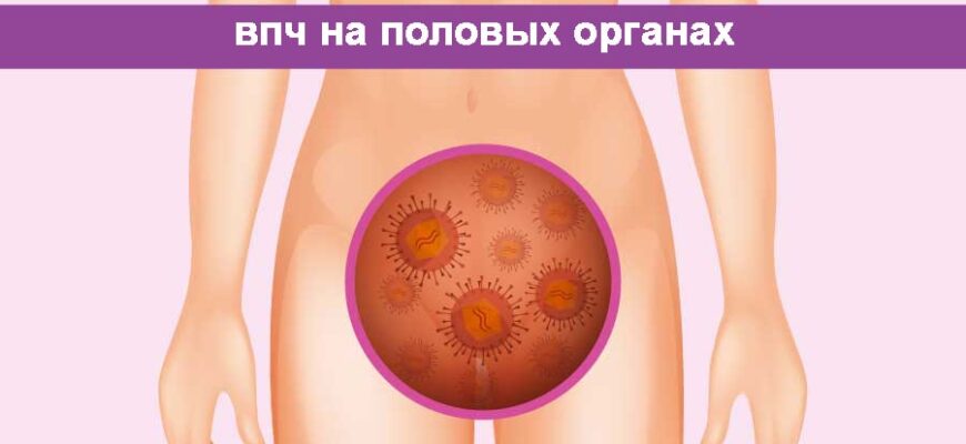 ВІЛ, герпес та папілома: сучасні методи діагностики та лікування