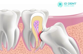 Ретенція: Ваша зброя для підвищення конкурентоспроможності бізнесу