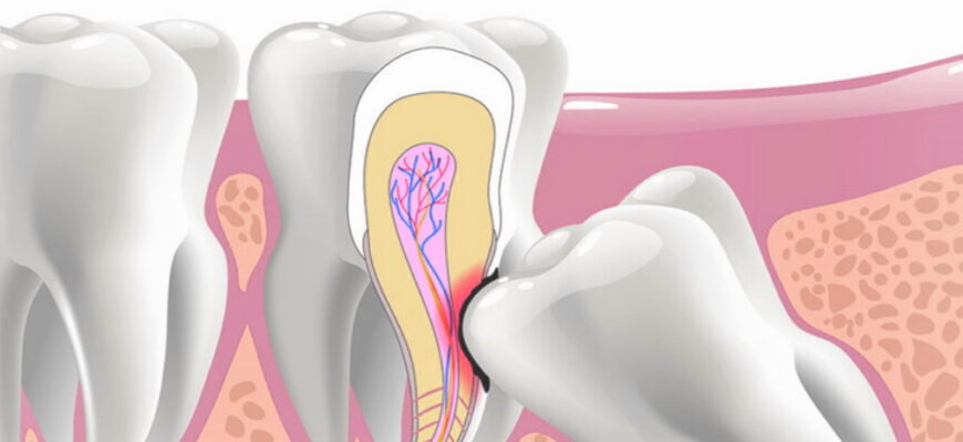 Ретенція: Ваша зброя для підвищення конкурентоспроможності бізнесу