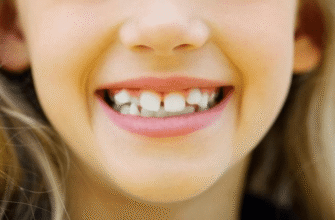 Діастема: причини, наслідки та способи усунення зубної щілини