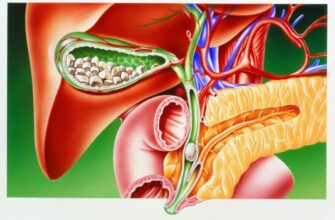 Холецистектомія: Що Це Таке, Процедура, Показання та Одужання