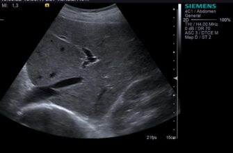 Що таке УЗД у режимі сірої шкали: основи та переваги методу