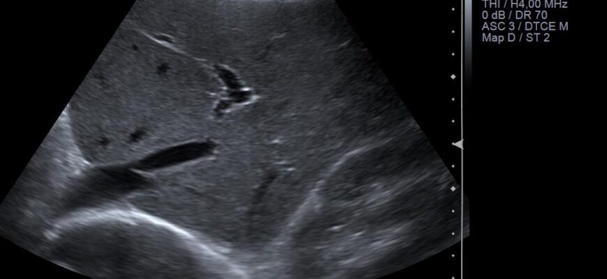 Що таке УЗД у режимі сірої шкали: основи та переваги методу