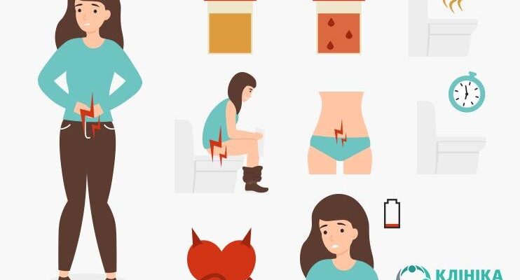 Заборонені продукти при циститі: що не можна їсти, щоб уникнути загострень