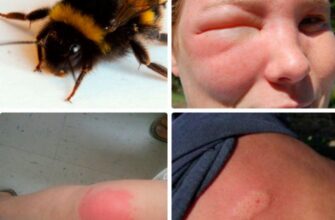 Що робити при укусі джмеля: ефективні поради та перевірені засоби