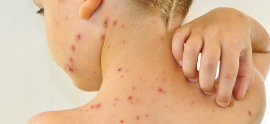 Причини виникнення висипу на шкірі: основні фактори та ризики