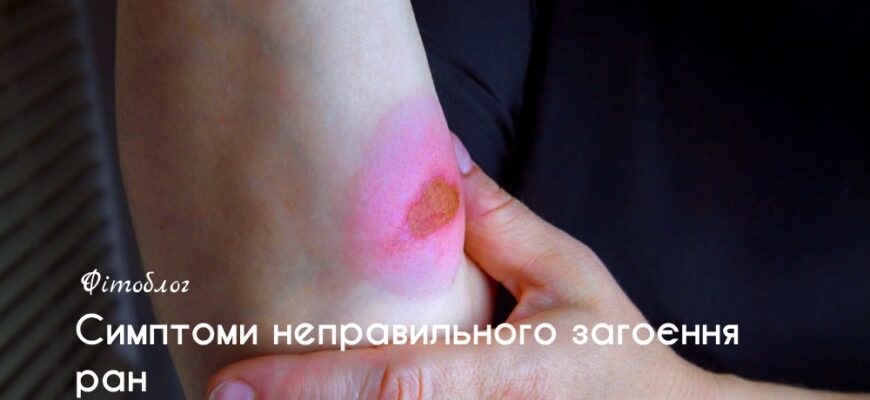 Як довго заживає скоринка на рані: ключові етапи та поради догляду