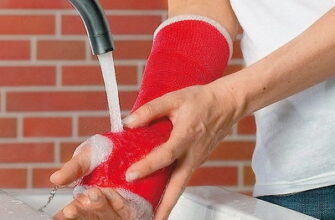 Чи дозволено мити гіпс водою? Поради та рекомендації експертів