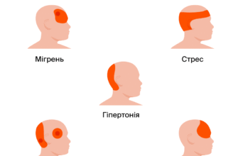 Найбезпечніші методи позбавлення головного болю: що обрати?