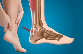 Ахіллове сухожилля: причини болю та ефективні методи лікування