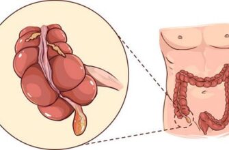 Біль після апендектомії: причини, лікування та відновлення