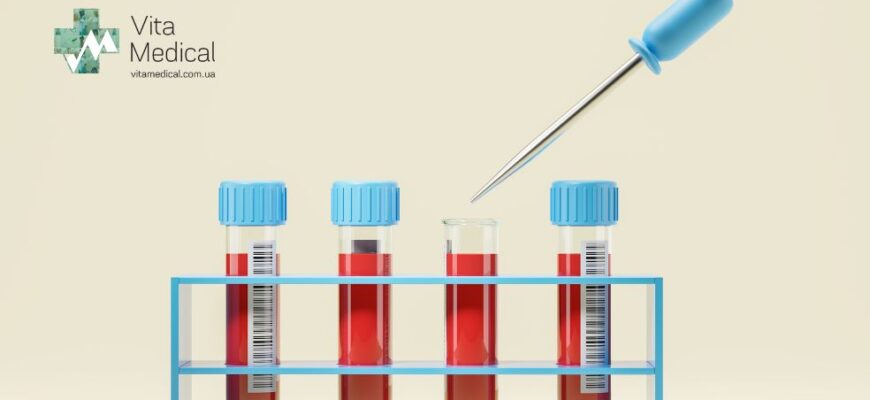 Біль після блокади: причини, симптоми та ефективні методи лікування