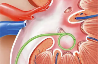 Біль після стентування нирки: причини, симптоми та лікування