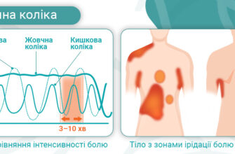 Біль справа внизу живота: причини та методи усунення дискомфорту