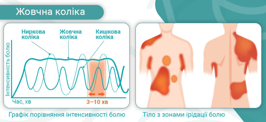 Біль справа внизу живота: причини та методи усунення дискомфорту