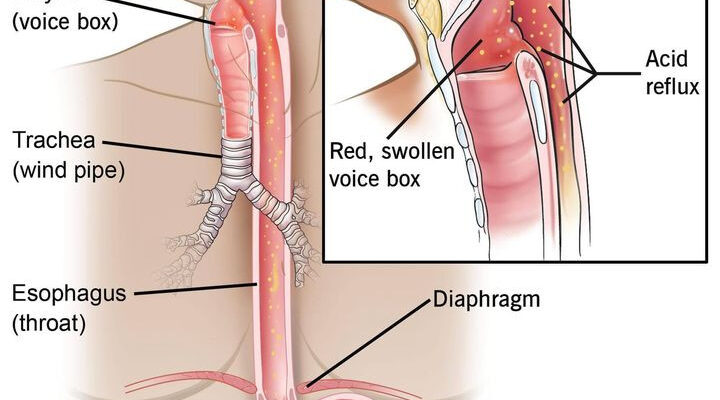 Біль у горлі при ковтанні: причини та зв’язок з болем у вухах