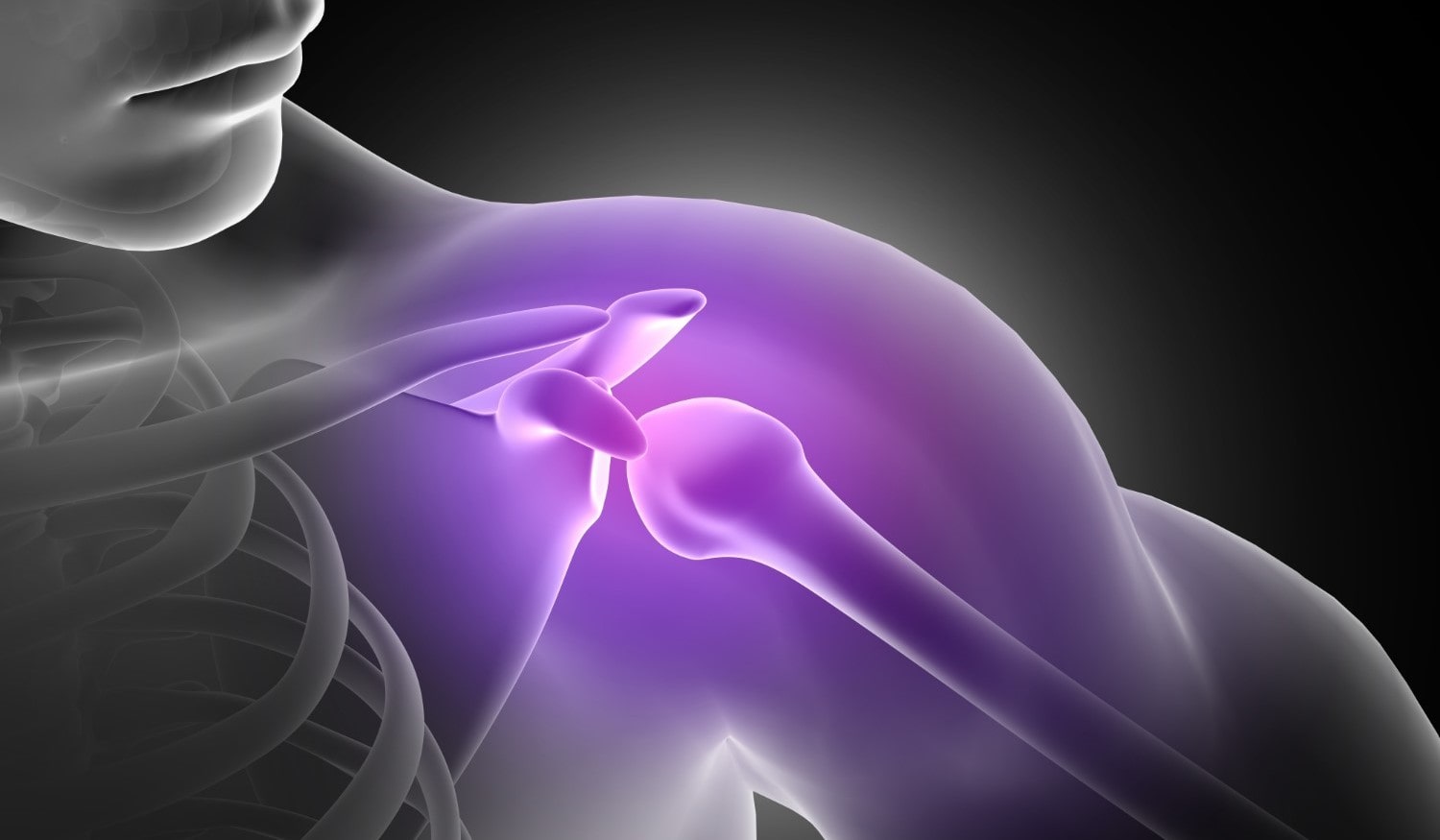 Біль у плечовому суглобі: лікування в Харкові | Rubinko