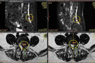 Біль у куприку: причини, симптоми та ефективні методи лікування