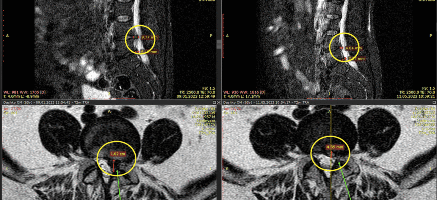 Біль у куприку: причини, симптоми та ефективні методи лікування
