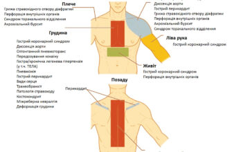 Біль у лівій груді: причини та методи ефективного лікування