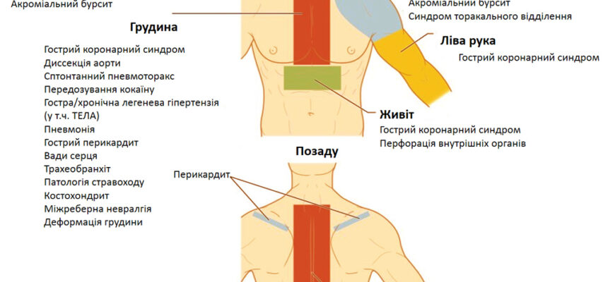 Біль у лівій груді: причини та методи ефективного лікування
