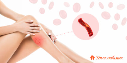 Здавлюючий біль у скронях, опис, чому виникає