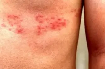 Біль у лівому боці знизу живота: причини та методи лікування