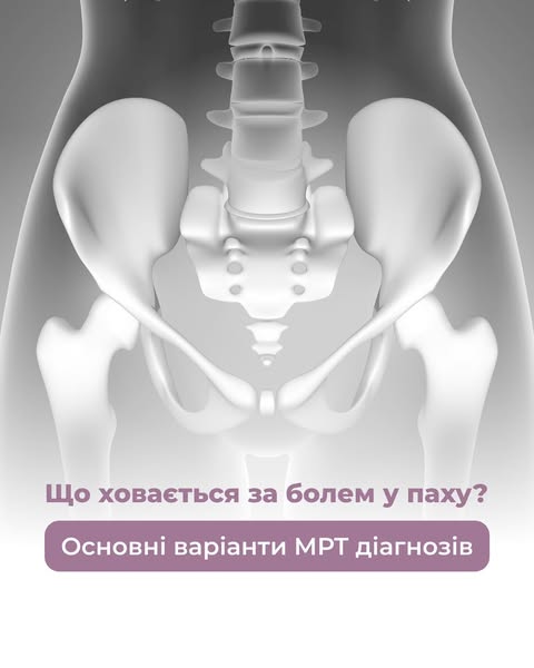 Przeciążone przywodziciele – ukryta przyczyna bólu pachwin i ...